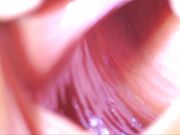 哇塞太刺激眼球 扒开女人阴道用手电看